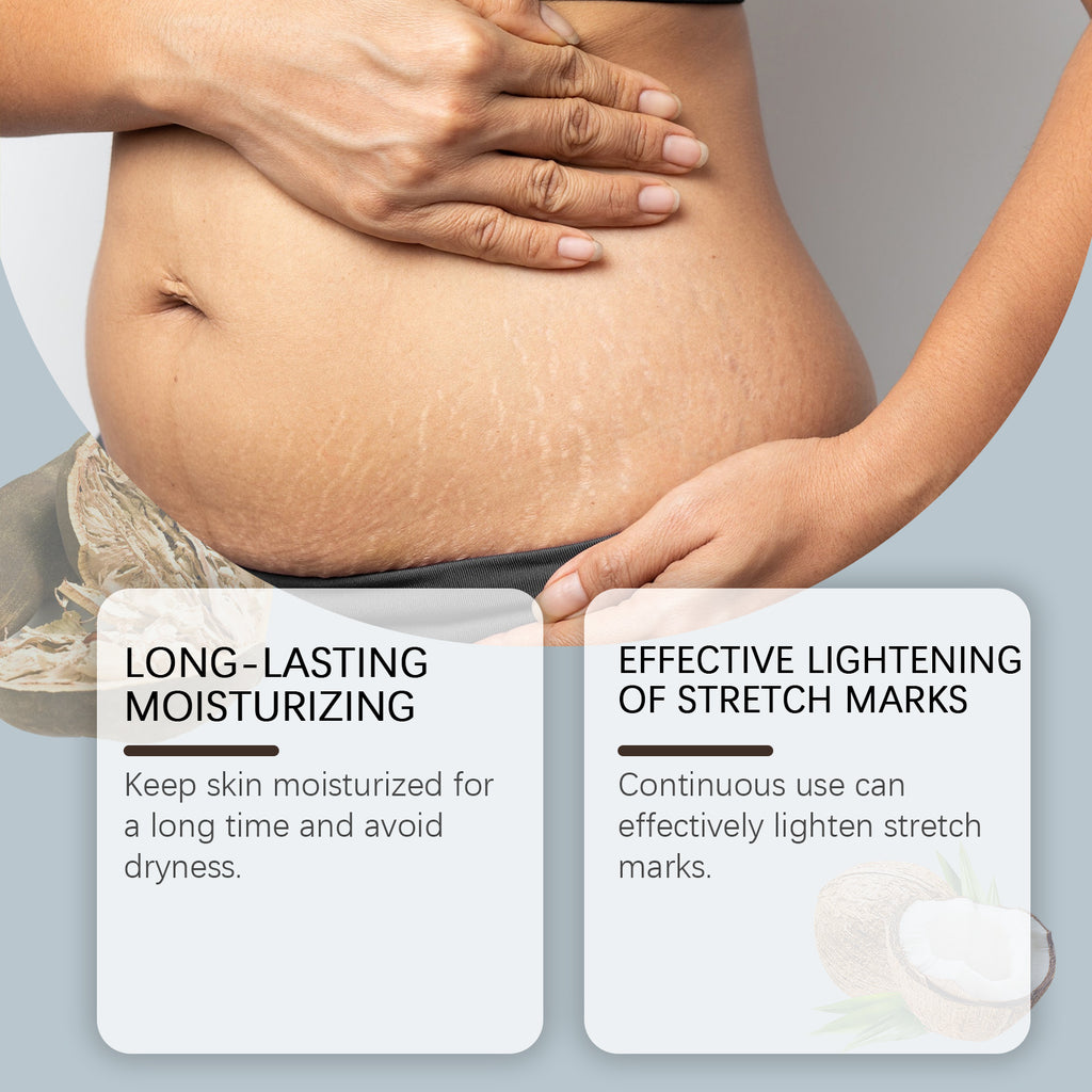 Skin Care Cream Post-Natal Body Skin Moisturizing Repair Nourishing Skin Moisturizing Skin Care Cream